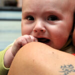 Infección por estreptococo del grupo B