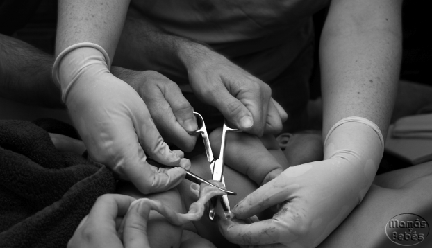 Desventajas del pinzamiento inmediato del cordón umbilical