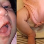 Madre en coma despierta al oír el llanto de su bebé